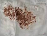 Stain Removal Chart 18